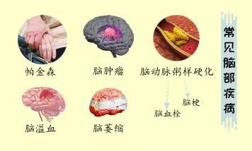 你的大腦“亞健康”了嗎？這些事情越早知道越好！